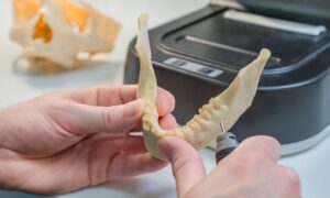 resina dental para impresora 3D Ecuador