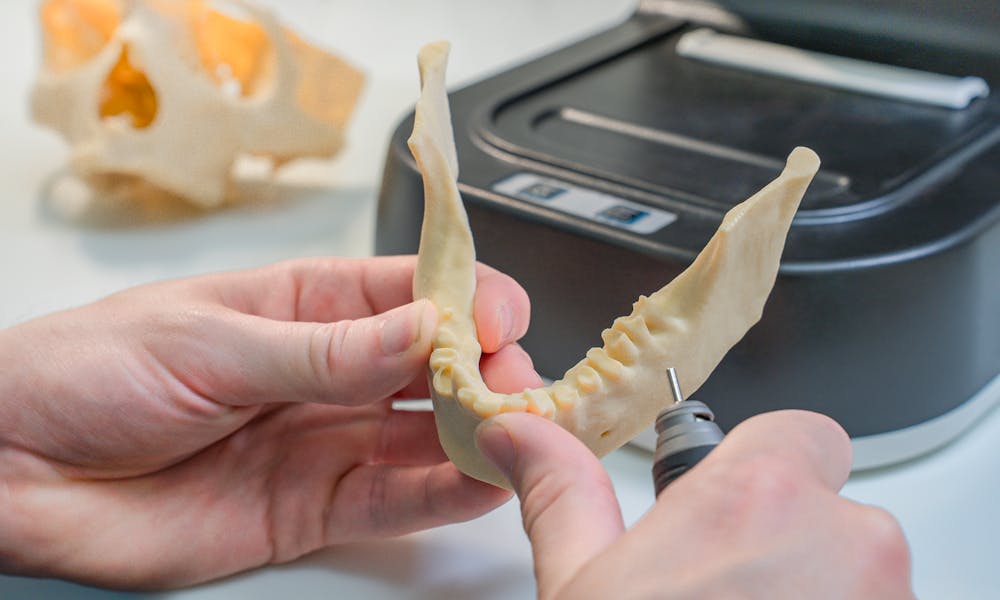 Resina dental para impresora 3D Ecuador: marcas, precios y compra